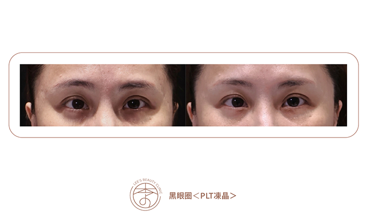 台中醫美推薦,台中醫美,台中減重,台中減重診所推薦,台中醫美診所推薦,台中醫美診所-李子美學診所