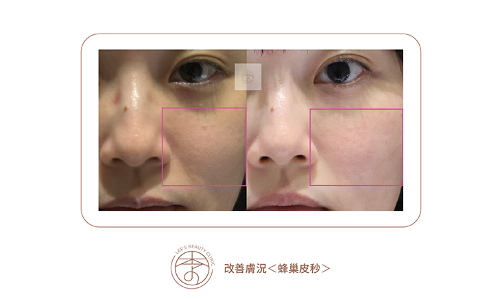 台中醫美推薦,台中醫美,台中減重,台中減重診所推薦,台中醫美診所推薦,台中醫美診所-李子美學診所