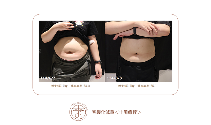 台中醫美推薦,台中醫美,台中減重,台中減重診所推薦,台中醫美診所推薦,台中醫美診所-李子美學診所